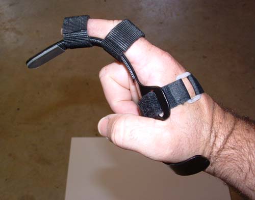 Thumbnail of Trigger Finger Aid.